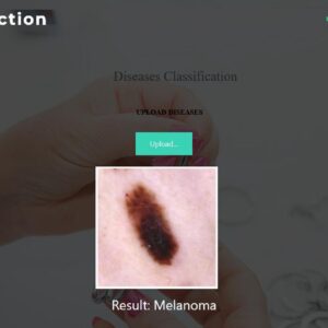 JPDL09-Skin Lesion Analysis towards Melanoma Detection