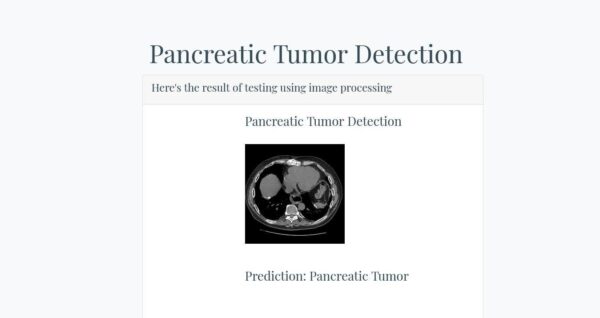 JPDL11-Pancreatic Tumor Detection