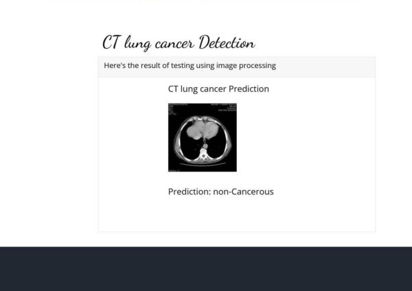 JPDL13-Lung Cancer Detection Using CNN
