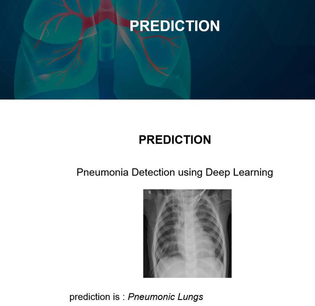 JPPY2209-Pneumonia Detection using Deep Learning