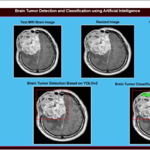 JPM2301-Brain Tumor Detection and Classification