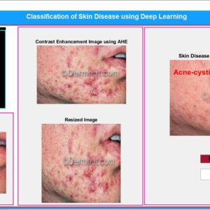 JPM2311-Skin Disease Classification