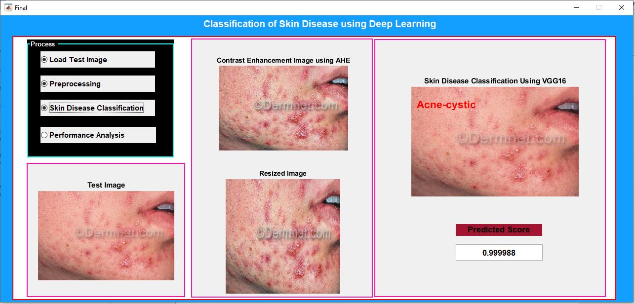 JPM2311-Skin Disease Classification