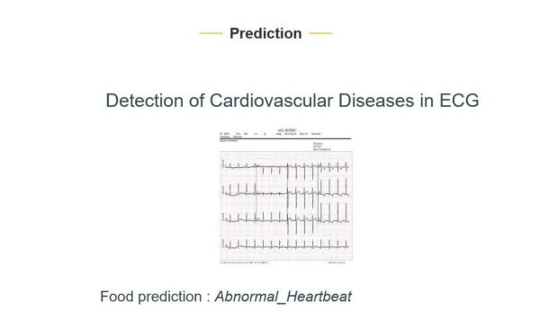 JPPY2305 - Detection of Cardiovascular Diseases in ECG Images Using ...