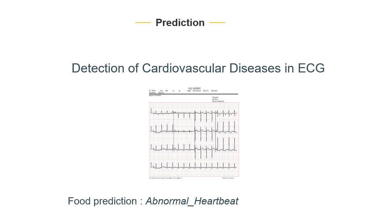 JPPY2305-Detection of Cardiovascular Diseases in ECG