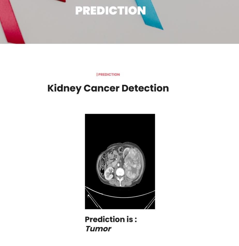 JPPY2311-Kidney Cancer Detection using Deep Learning