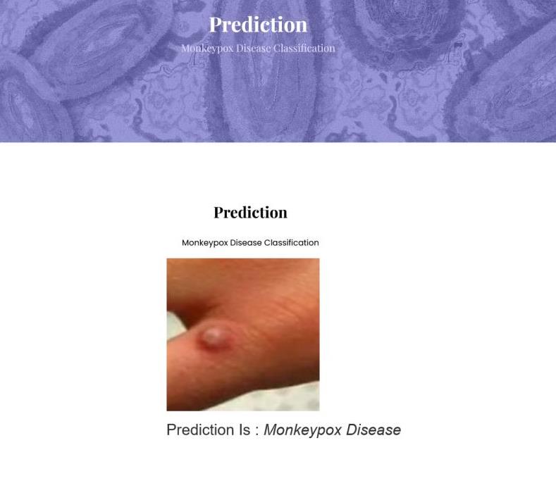 JPPY2313-Monkeypox Disease Classification