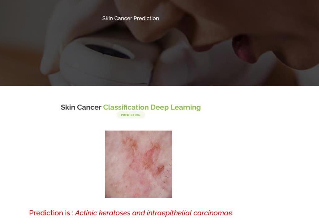 JPPY2318-Skin Cancer Prediction