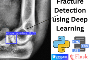 JPPY2502-Bone Fracture Detection